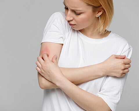 Woman itching arm